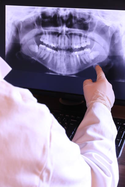 Best Emergency Wisdom Tooth Extraction in Epworth, IA